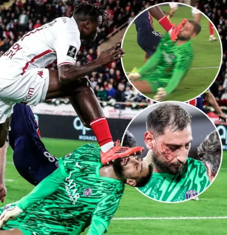 太狠了！清晨曼联单刀错失赛前巴黎圣日耳曼调整名单以备欧篮联，AC米兰临场应变的简单介绍